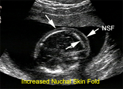 Real-Time B-Mode Ultrasound